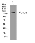 Anti-CCHCR1 antibody (180-230 aa) (STJ194886) – Figure 1 of 1