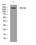 Anti-ZNF142 antibody (616-666 aa) (STJ194925) – Figure 1 of 1