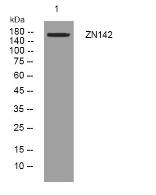 Anti-ZNF142 antibody (616-666 aa) (STJ194925) – Figure 1 of 1