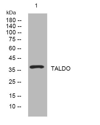 Anti-TALDO1 antibody (21-71 aa) (STJ194940) – Figure 1 of 1