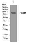 Anti-FBXO41 antibody (622-672 aa) (STJ194945) – Figure 1 of 1