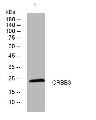 Anti-CRYBB3 antibody (110-160 aa) (STJ194961) – Figure 1 of 1
