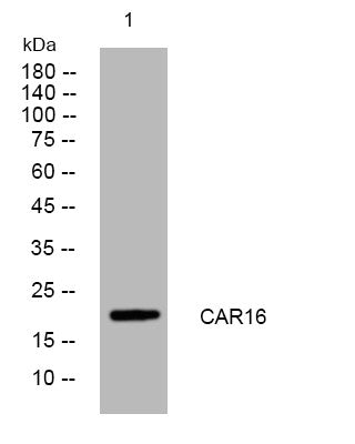 Anti-CARD16 antibody (101-151 aa) (STJ194980) – Figure 1 of 1