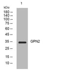 Anti-GPN2 antibody (146-196 aa) (STJ195006) – Figure 1 of 1