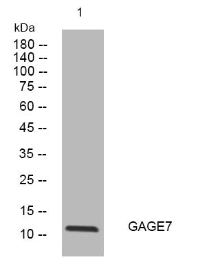 Anti-GAGE7 antibody (41-91 aa) (STJ195039) – Figure 1 of 1