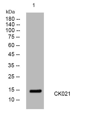 Anti-C11orf21 antibody (16-66 aa) (STJ195137) – Figure 1 of 1