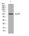 Anti-ALDH7A1 antibody (229-279 aa) (STJ195163) – Figure 1 of 1