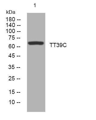 Anti-TTC39C antibody (229-279 aa) (STJ195173) – Figure 1 of 1