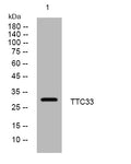 Anti-TTC33 antibody (114-164 aa) (STJ195234) – Figure 1 of 1