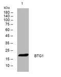 Anti-BTG1 antibody (27-77 aa) (STJ195257) – Figure 1 of 1