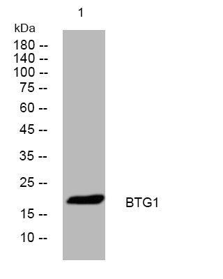 Anti-BTG1 antibody (27-77 aa) (STJ195257) – Figure 1 of 1