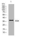 Anti-EI24 antibody (107-157 aa) (STJ195264) – Figure 1 of 1