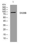Anti-INTS6L antibody (166-216 aa) (STJ195320) – Figure 1 of 1