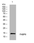 Anti-FABP9 antibody (43-93 aa) (STJ195322) – Figure 1 of 1