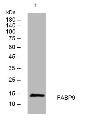 Anti-FABP9 antibody (43-93 aa) (STJ195322) – Figure 1 of 1