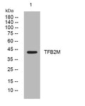 Anti-TFB2M antibody (192-242 aa) (STJ195420) – Figure 1 of 1