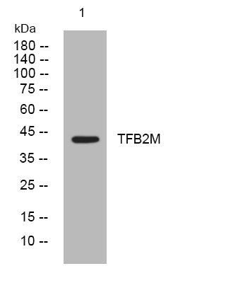 Anti-TFB2M antibody (192-242 aa) (STJ195420) – Figure 1 of 1