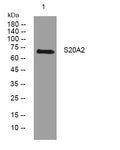 Anti-SLC20A2 antibody (370-420 aa) (STJ195451) – Figure 1 of 1