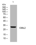 Anti-CD99L2 antibody (204-254 aa) (STJ195459) – Figure 1 of 1