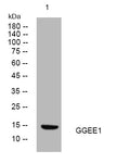 Anti-PAGE5 antibody (35-85 aa) (STJ195463) – Figure 1 of 1
