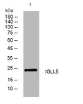 Anti-IGLL5 antibody (50-100 aa) (STJ195518) – Figure 1 of 1