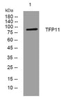 Anti-TFIP11 antibody (210-260 aa) (STJ195529) – Figure 1 of 1