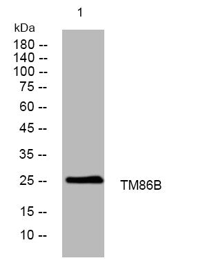 Anti-TMEM86B antibody (46-96 aa) (STJ195562) – Figure 1 of 1