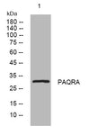 Anti-MMD2 antibody (30-80 aa) (STJ195590) – Figure 1 of 1