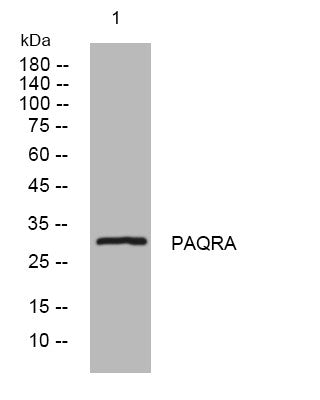 Anti-MMD2 antibody (30-80 aa) (STJ195590) – Figure 1 of 1