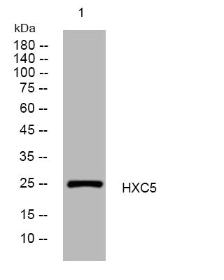 Anti-HOXC5 antibody (106-156 aa) (STJ195604) – Figure 1 of 1