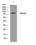 Anti-ZNF606 antibody (557-607 aa) (STJ195607) – Figure 1 of 1