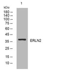 Anti-ERLIN2 antibody (239-289 aa) (STJ195613) – Figure 1 of 1