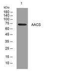 Anti-AACS antibody (193-243 aa) (STJ195617) – Figure 1 of 1