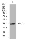Anti-KCTD10 antibody (67-117 aa) (STJ195644) – Figure 1 of 1