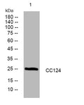 Anti-CCDC124 antibody (56-106 aa) (STJ195673) – Figure 1 of 1