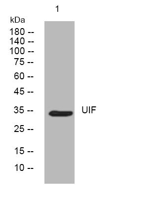 Anti-FYTTD1 antibody (50-100 aa) (STJ195705) – Figure 1 of 1
