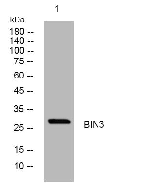 Anti-BIN3 antibody (184-234 aa) (STJ195772) – Figure 1 of 1