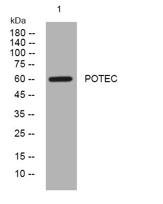 Anti-POTEC antibody (265-315 aa) (STJ195807) – Figure 1 of 1