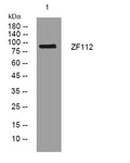 Anti-ZNF112 antibody (311-361 aa) (STJ195822) – Figure 1 of 1