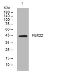Anti-FBXO22 antibody (182-232 aa) (STJ195843) – Figure 1 of 1