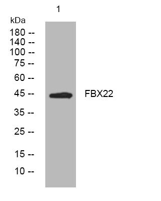 Anti-FBXO22 antibody (182-232 aa) (STJ195843) – Figure 1 of 1