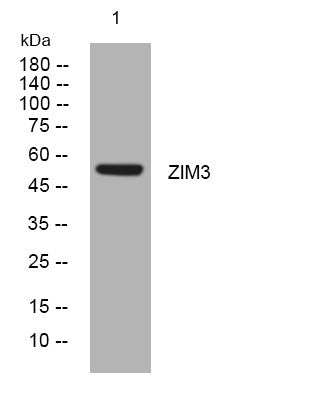 Anti-ZIM3 antibody (98-148 aa) (STJ195849) – Figure 1 of 1