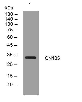 Anti-CCDC198 antibody (191-241 aa) (STJ195864) – Figure 1 of 1