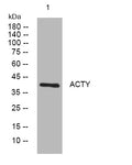 Anti-ACTR1B antibody (29-79 aa) (STJ195888) – Figure 1 of 1