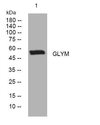 Anti-SHMT2 antibody (122-172 aa) (STJ195907) – Figure 1 of 1