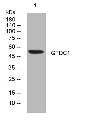 Anti-GTDC1 antibody (273-323 aa) (STJ195917) – Figure 1 of 1