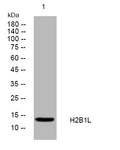 Anti-H2BC13 antibody (34-84 aa) (STJ195934) – Figure 1 of 1