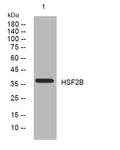 Anti-HSF2BP antibody (201-251 aa) (STJ195935) – Figure 1 of 1