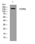 Anti-TECPR2 antibody (598-648 aa) (STJ195941) – Figure 1 of 1