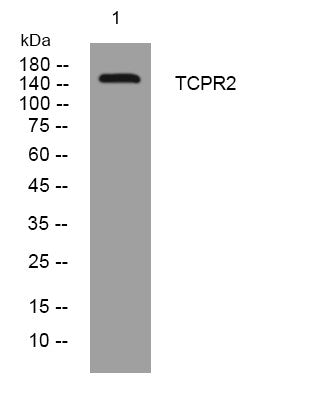 Anti-TECPR2 antibody (598-648 aa) (STJ195941) – Figure 1 of 1